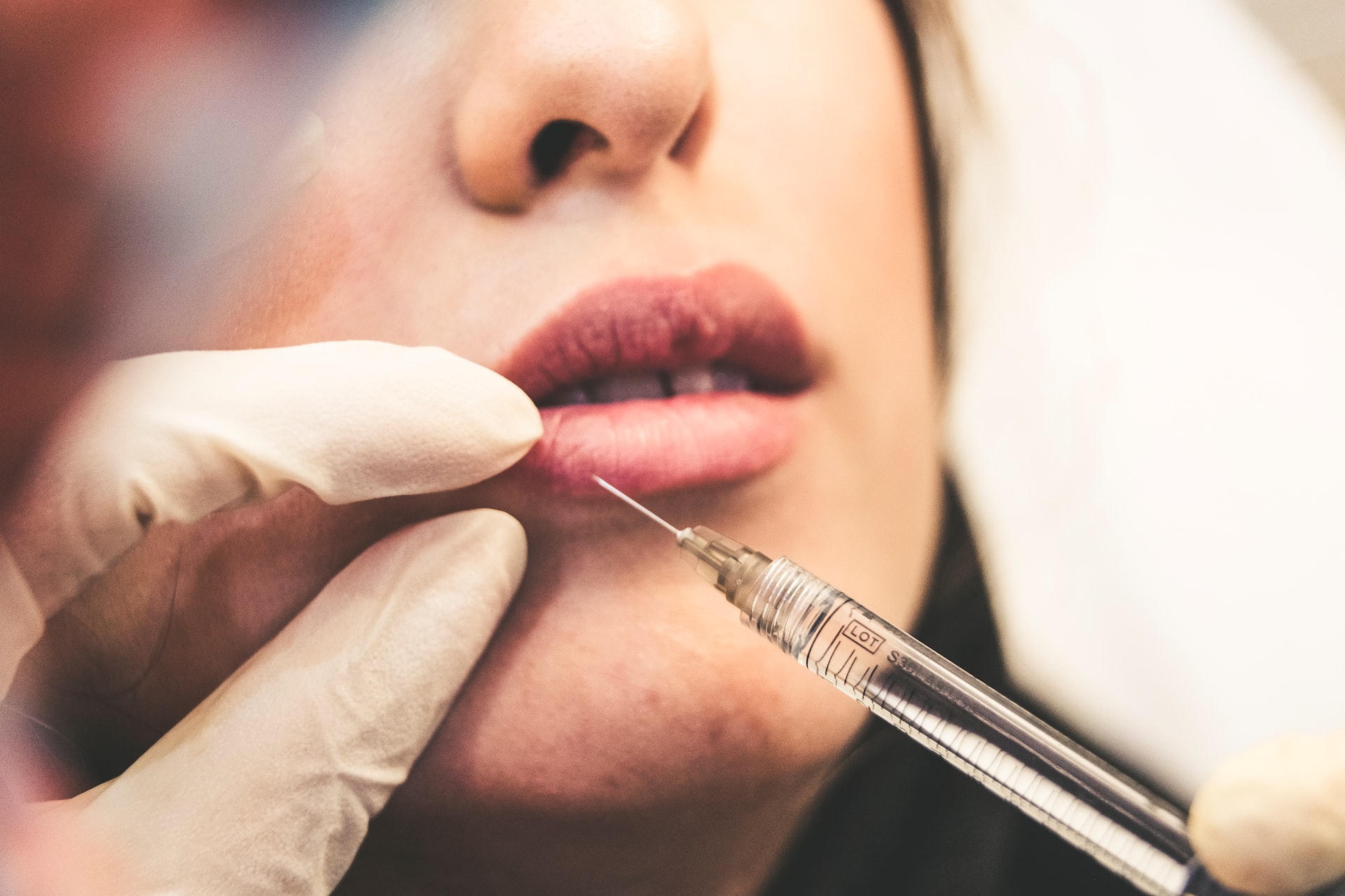 Cosmetic surgery lip filler