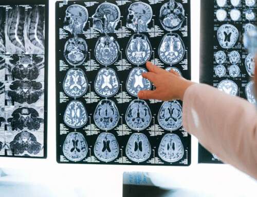 I’ve seen the brain damage contact sports can cause – we all need to take concussion and CTE more seriously